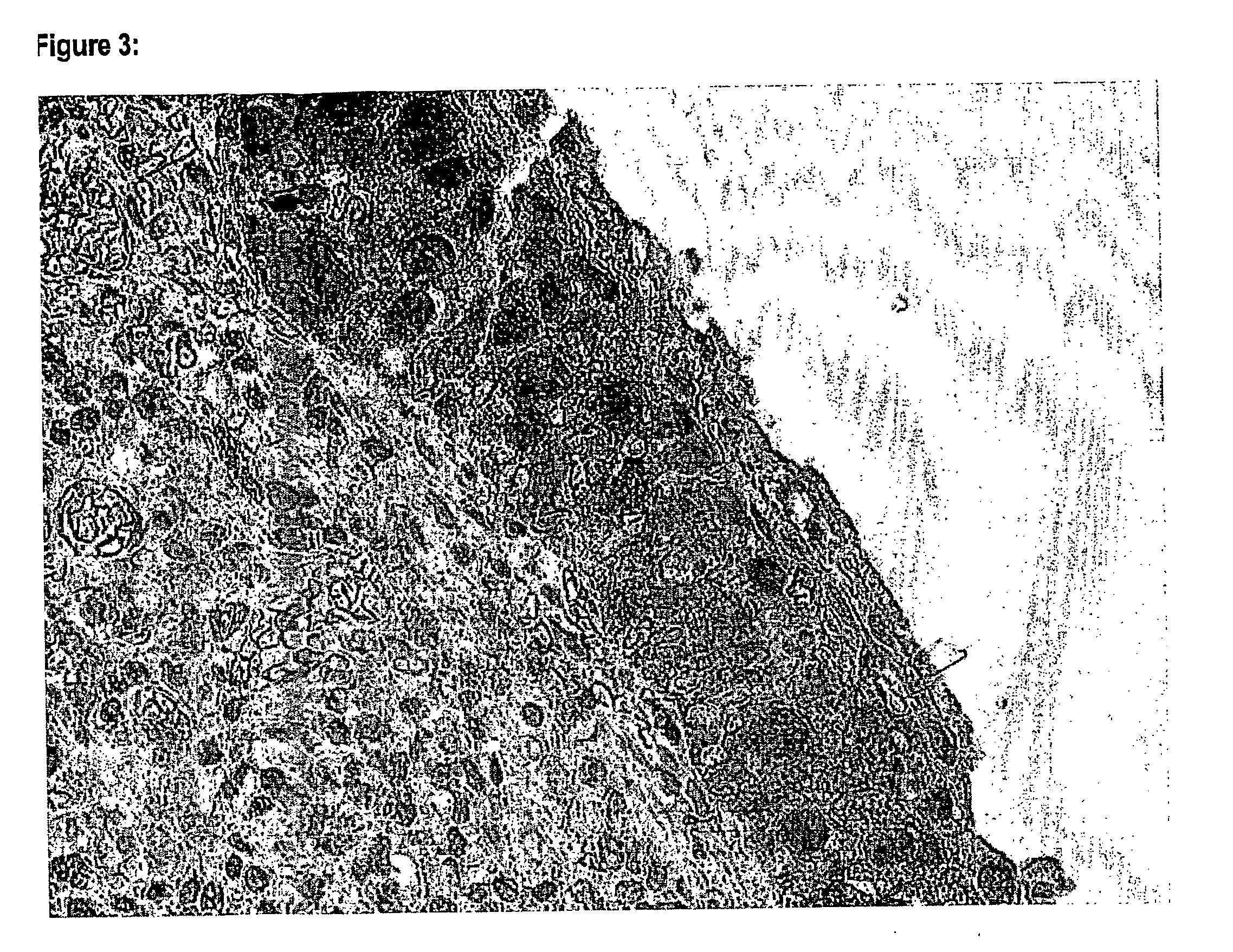 Compositions and methods for diagnosis and therapy of cancers