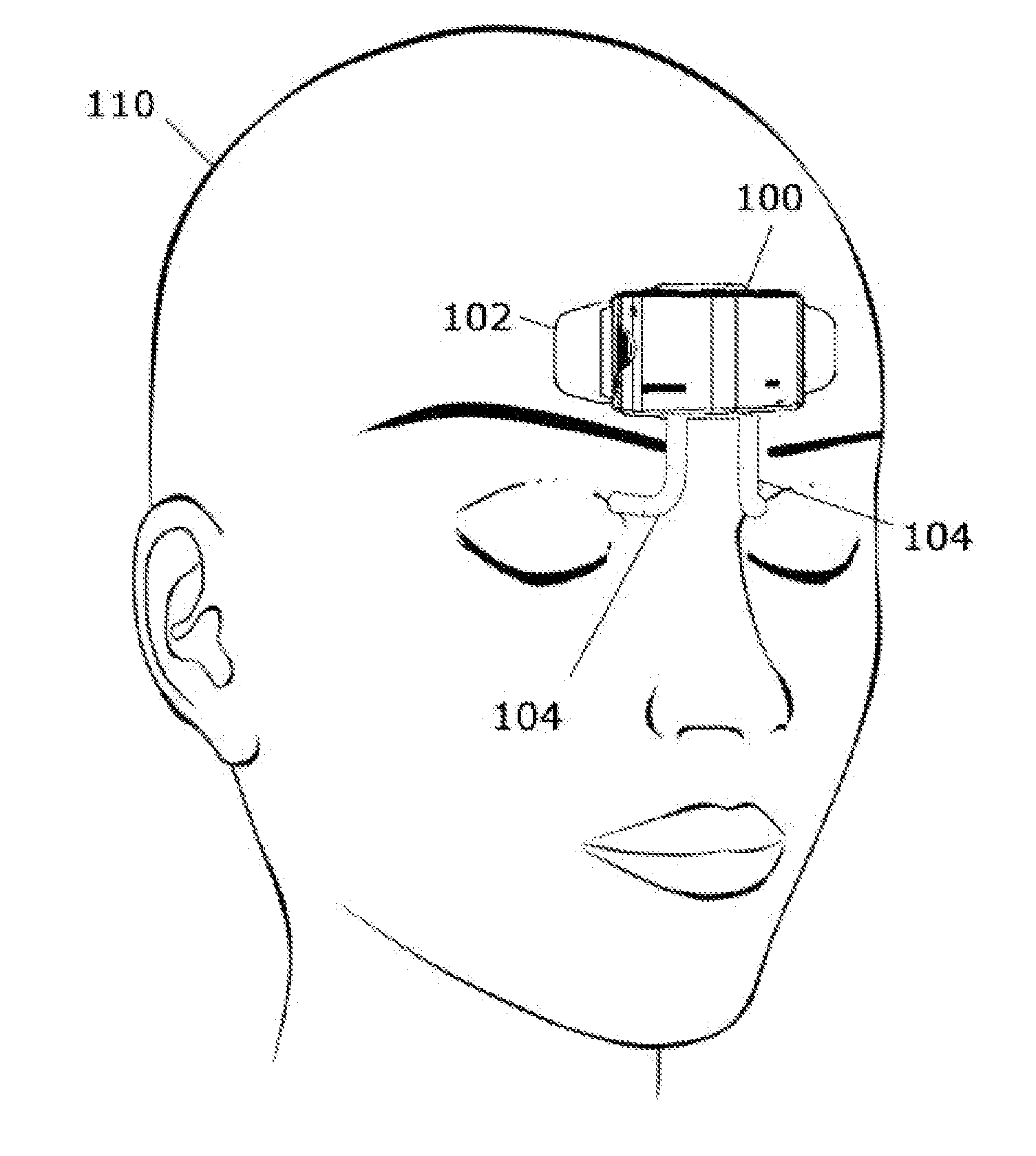 Forehead-wearable light stimulator having one or more light pipes