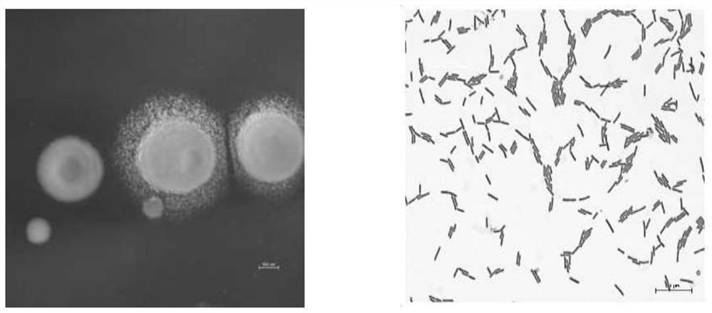 Biocontrol plant endophytic bacterium ZN-S2 and application thereof