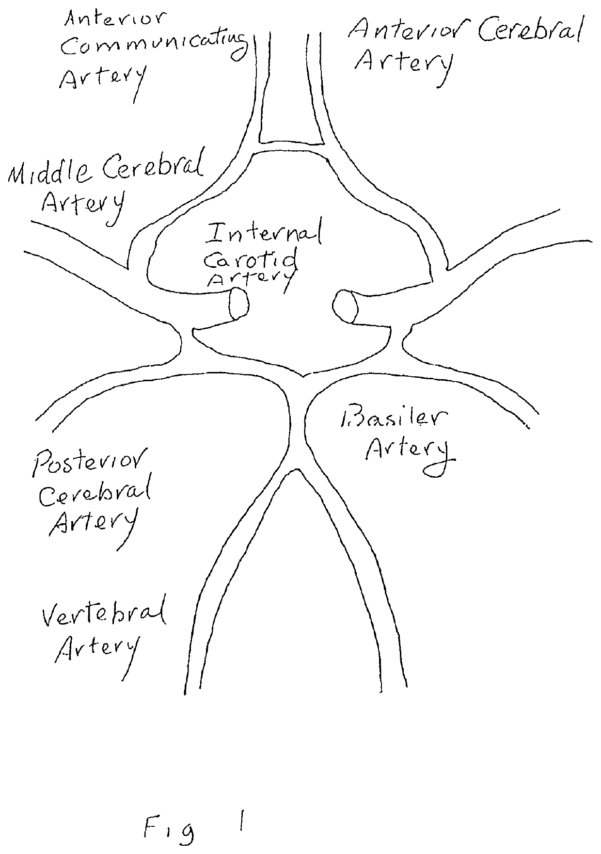 Methods and devices to ameliorate vascular obstruction