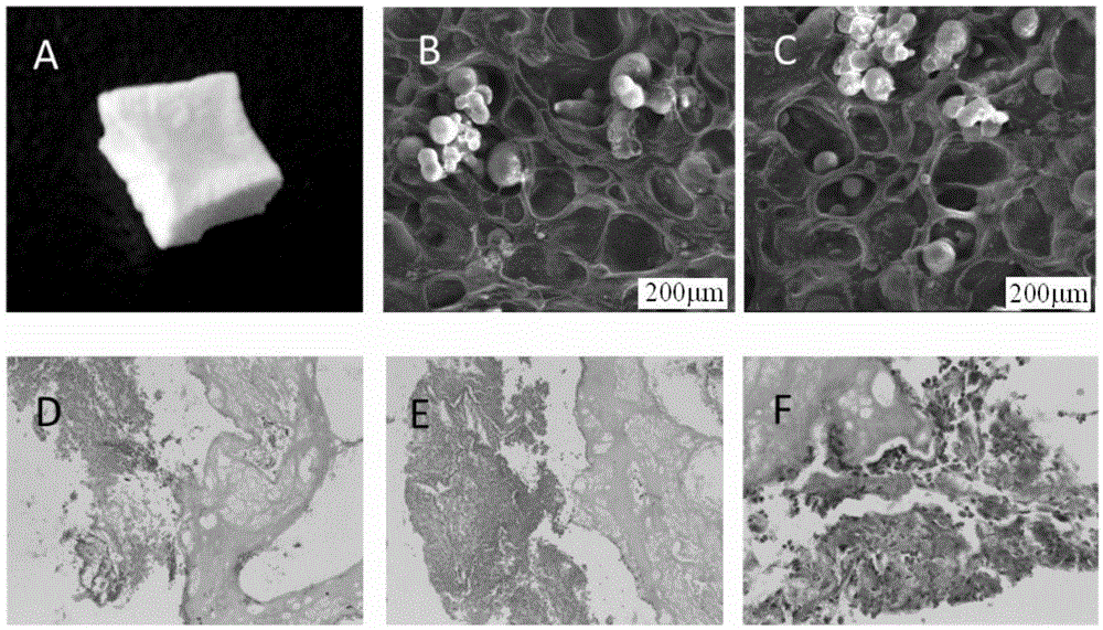 Preparation method for artificial cartilage