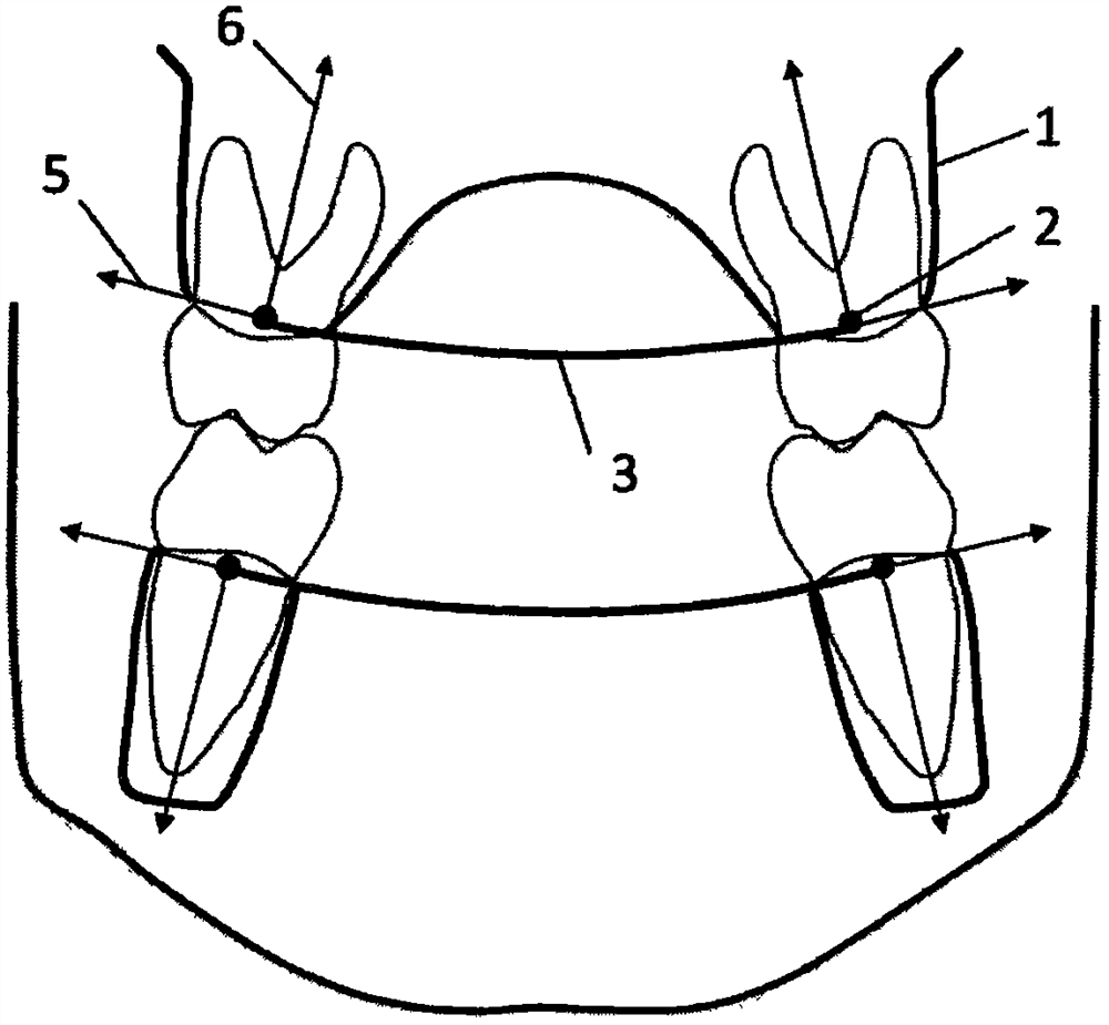 Tooth movement evaluation method under curve natural coordinate system based on alveolar bone form