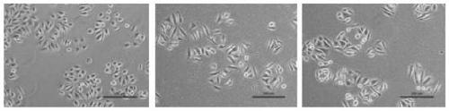 Application of eudesmane sesquiterpene lactone epimers in preparation of anti-breast cancer medicine