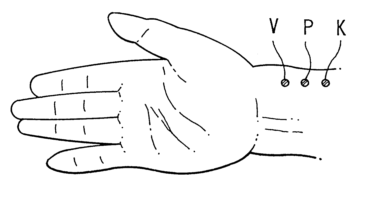 Diagnostic apparatus for analyzing arterial pulse waves