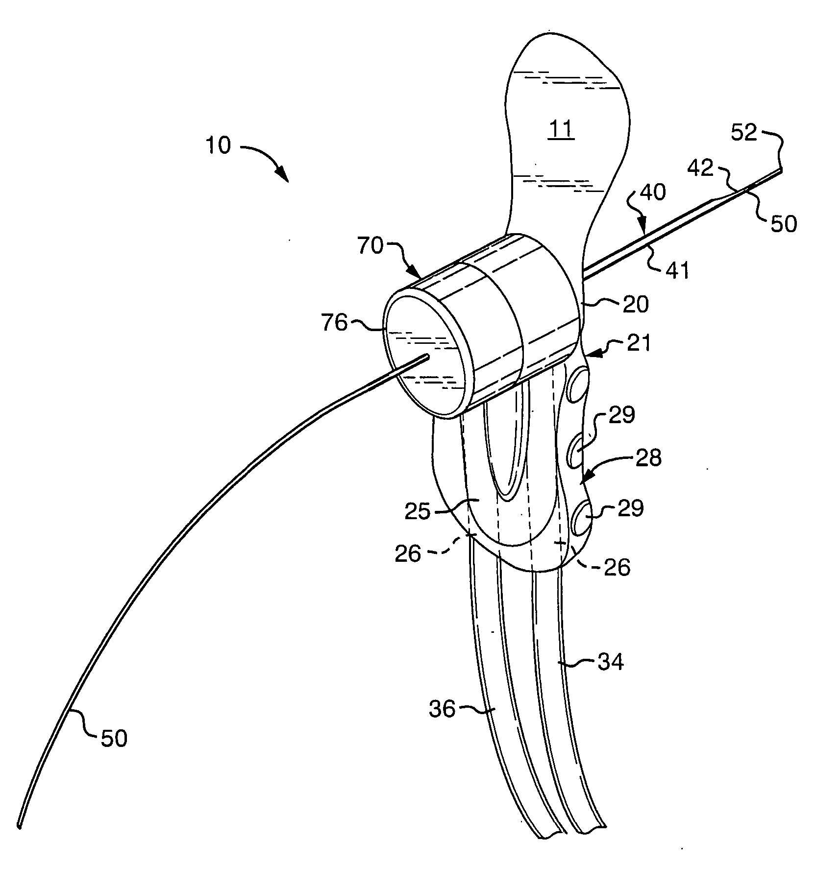 Ductal lavage microcatheter with user activated valve and nitinol introducer