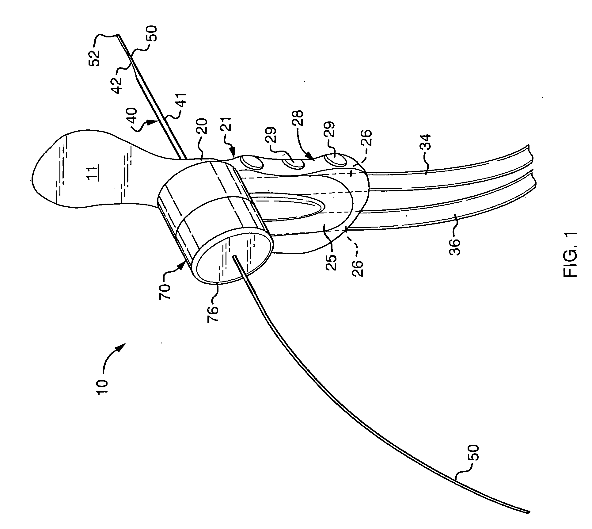 Ductal lavage microcatheter with user activated valve and nitinol introducer