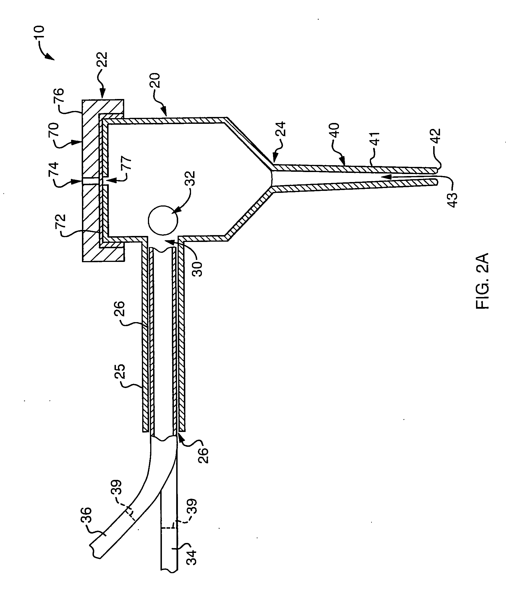 Ductal lavage microcatheter with user activated valve and nitinol introducer