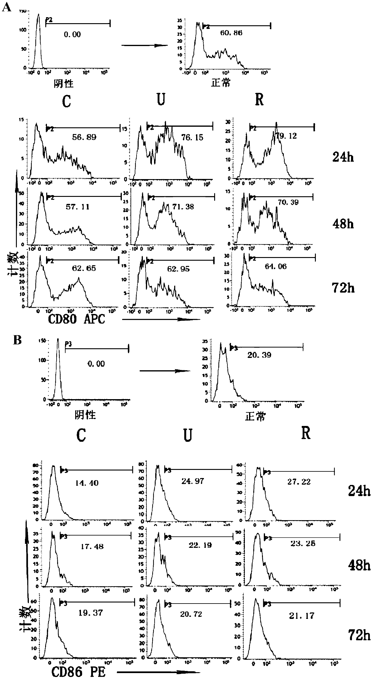 New application of recombinant human urinary trypsin inhibitor