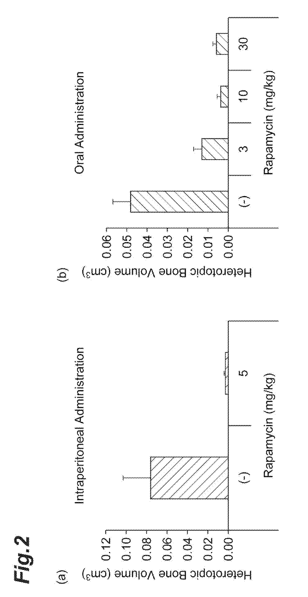 Therapeutic Agent for Fibrodysplasia Ossificans Progressiva