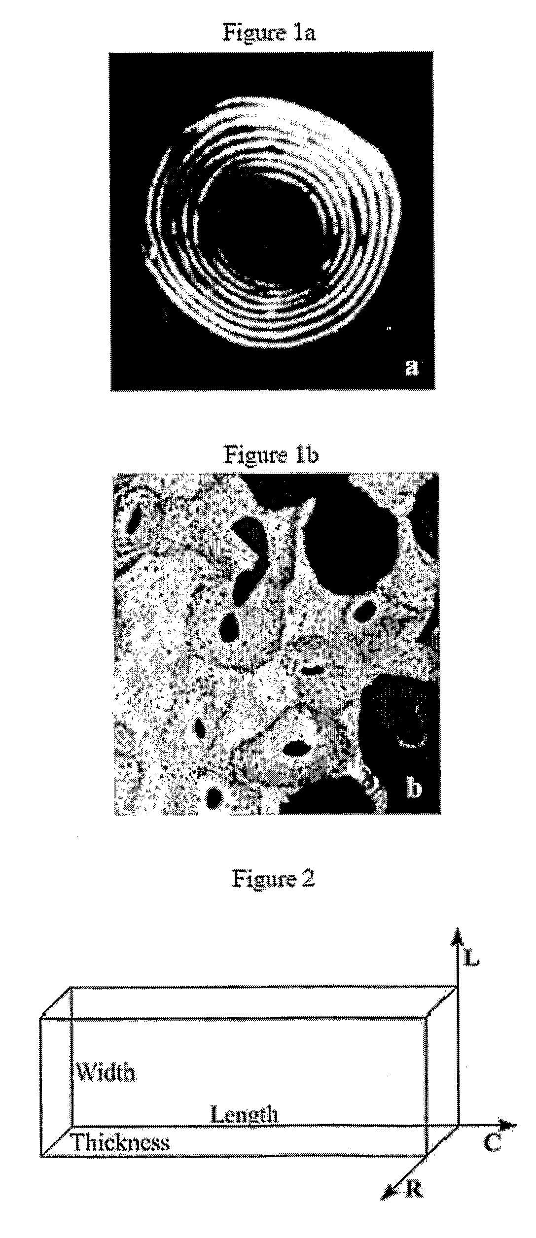 Method and System for Modeling Bone Structure