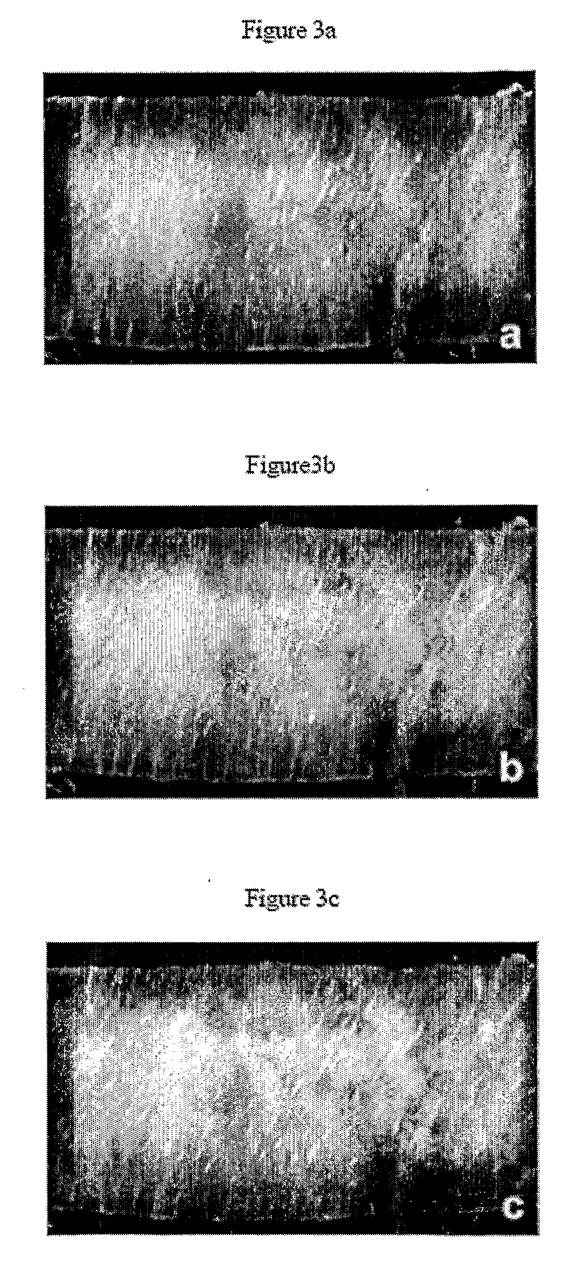 Method and System for Modeling Bone Structure