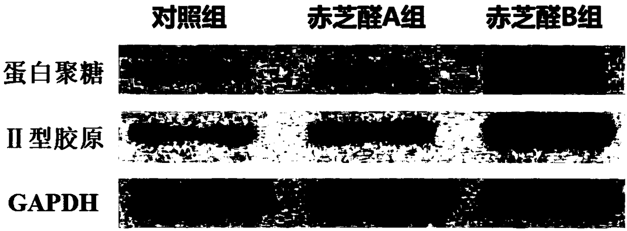 Culture method for inducing chondrogenic differentiation of adipose-derived stem cells and culture solution