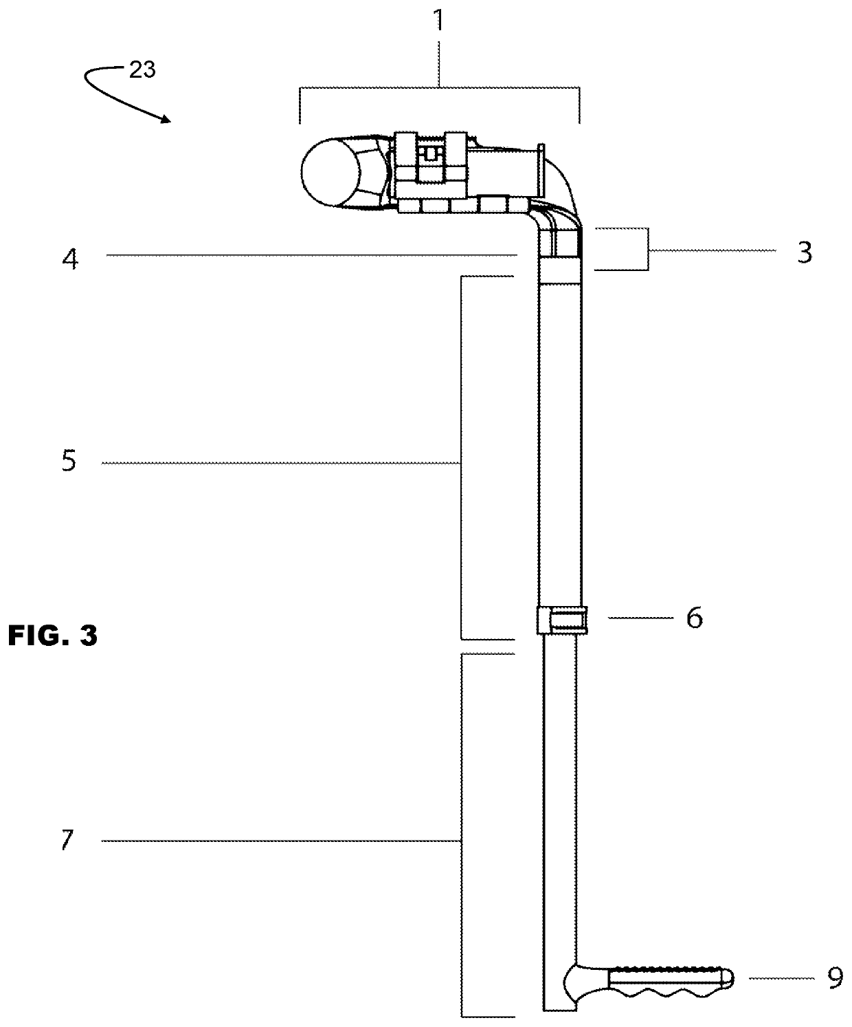 Universal Ischemic Compression Device