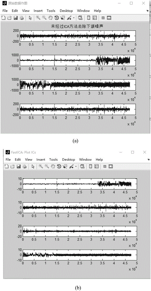 Method for automatically removing lower jaw interference from multi-channel electroencephalogram (EEG)