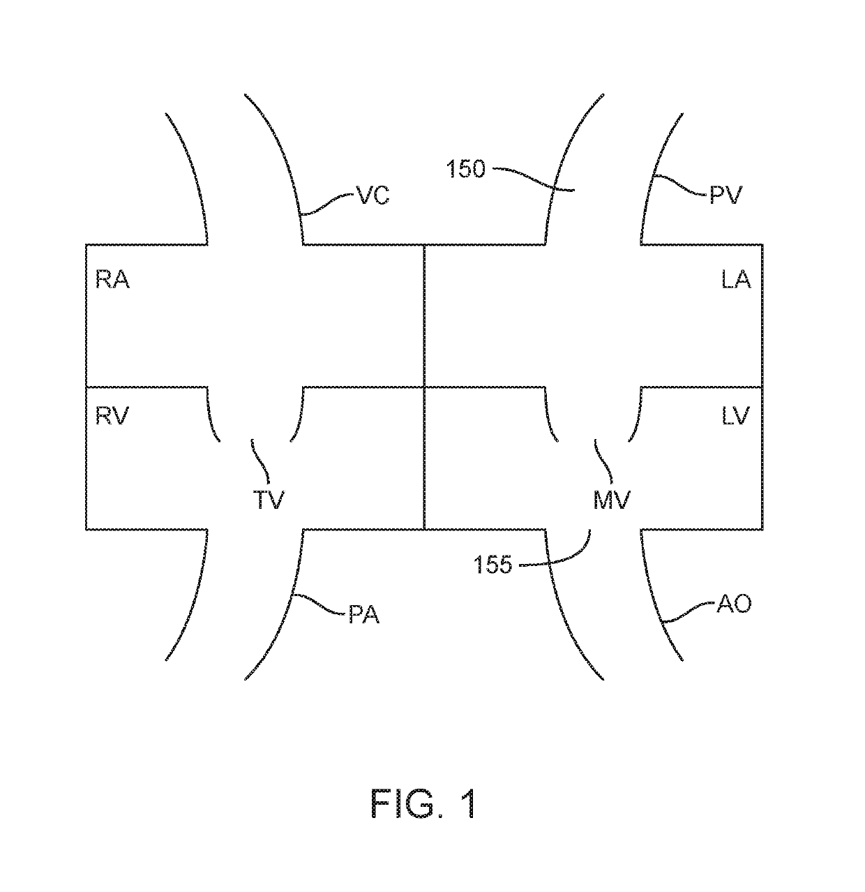 Antegrade hemodynamic support