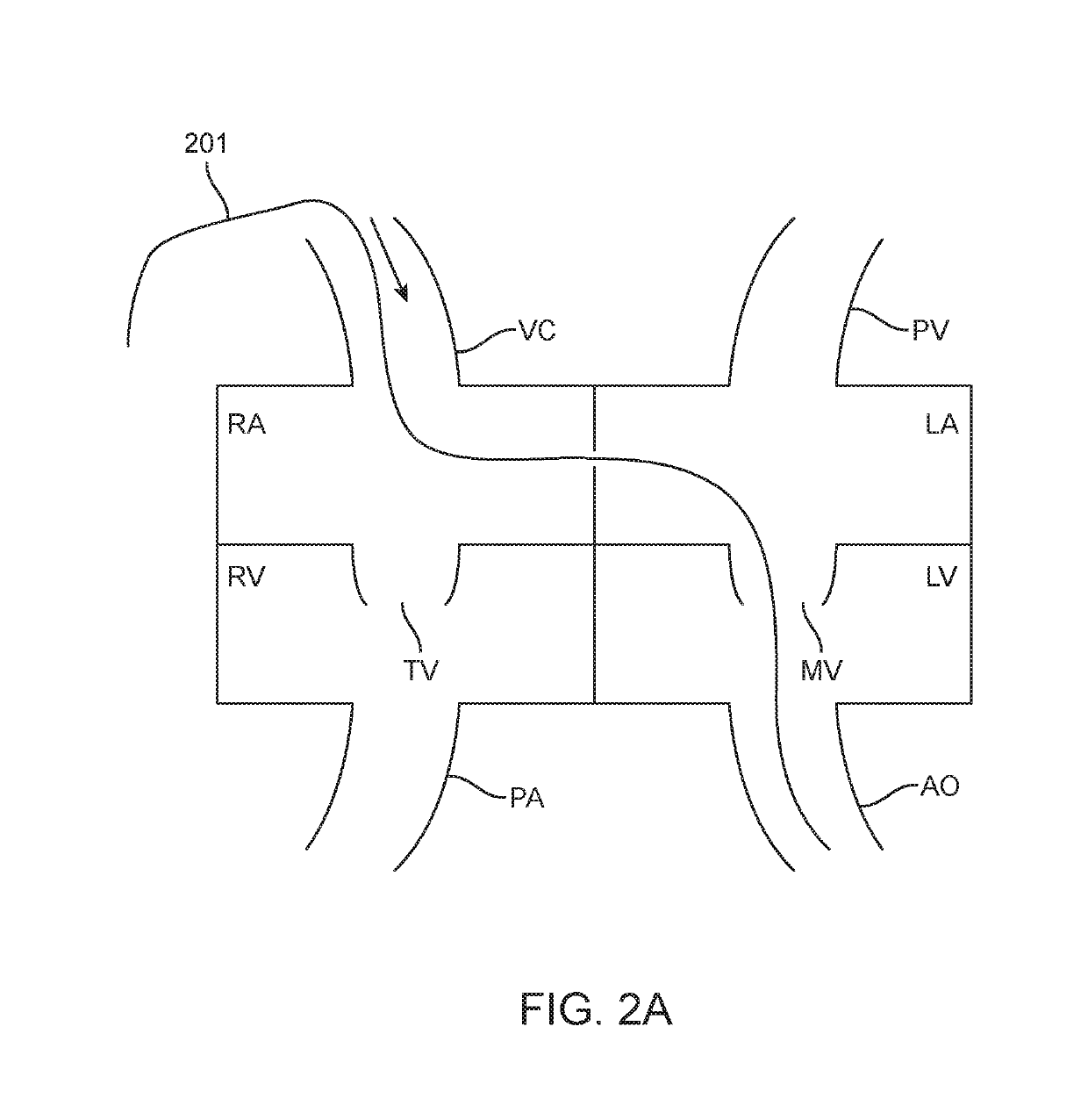 Antegrade hemodynamic support