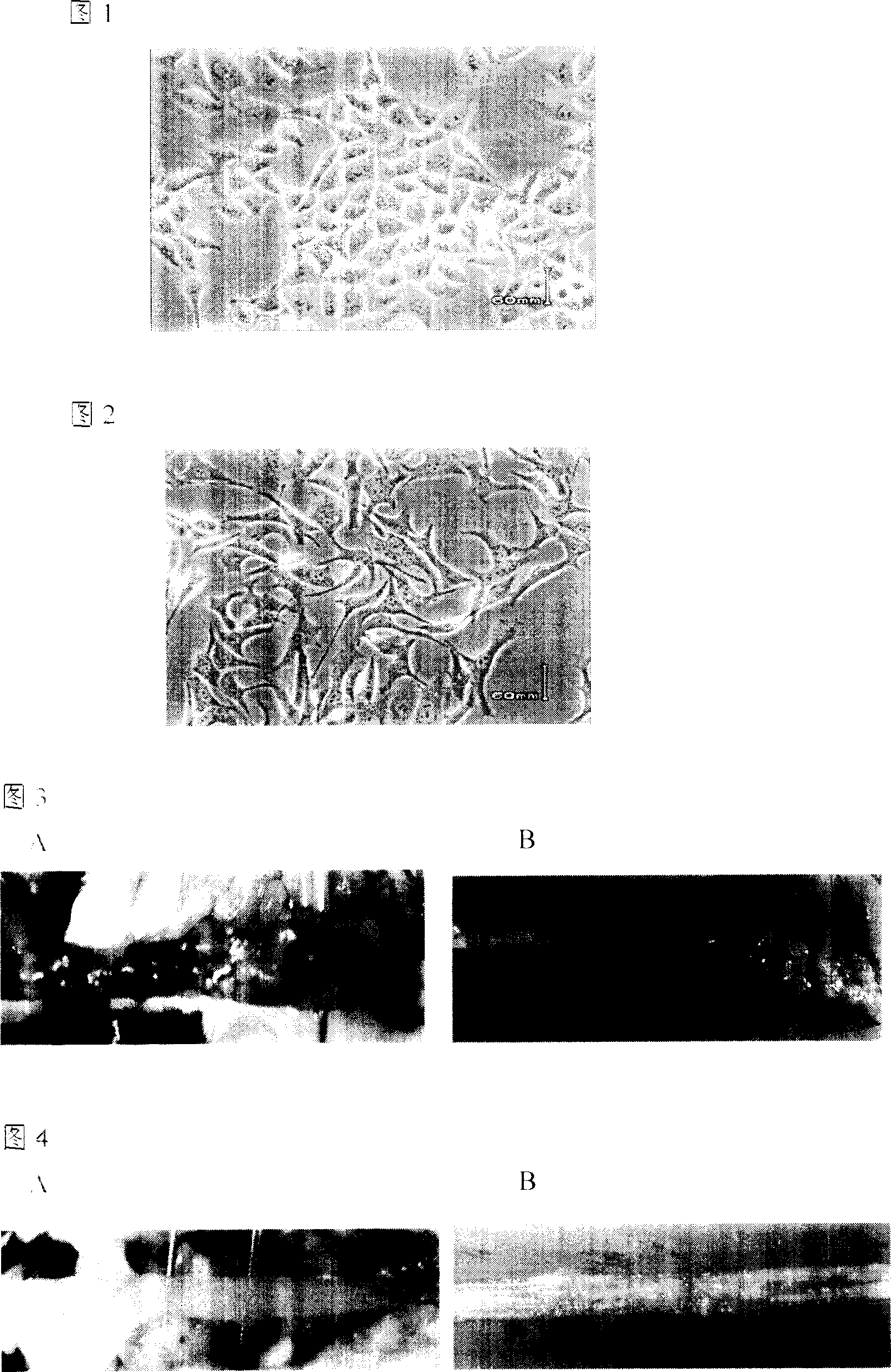 Medicine composition for treating and preventing stomach and intestine tumor