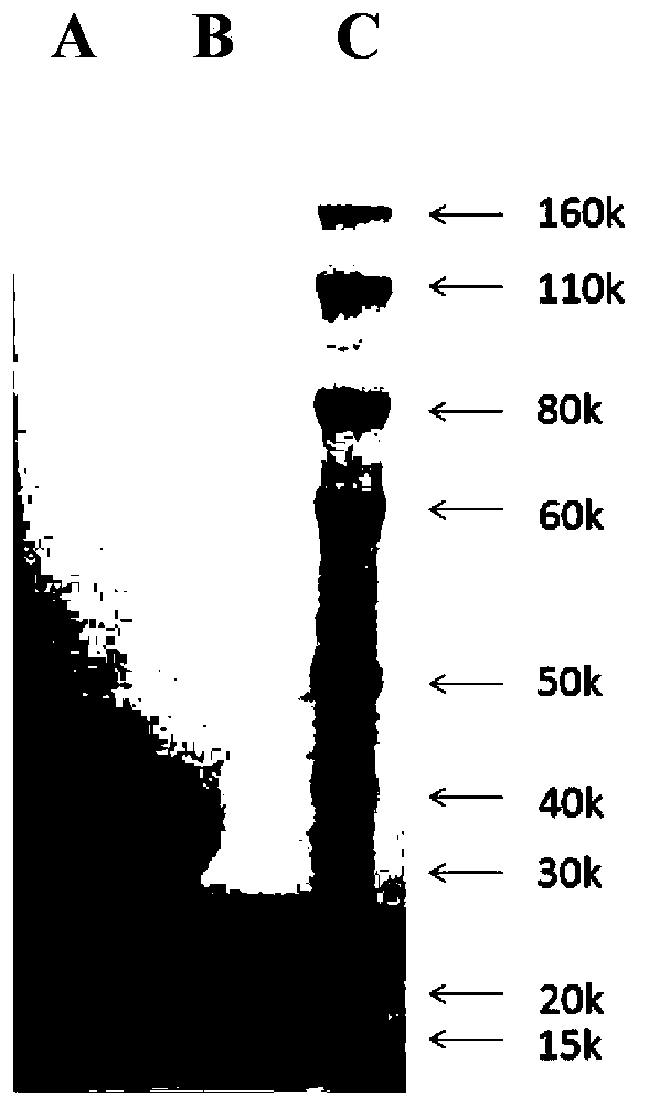 Anti-BLyS antibody