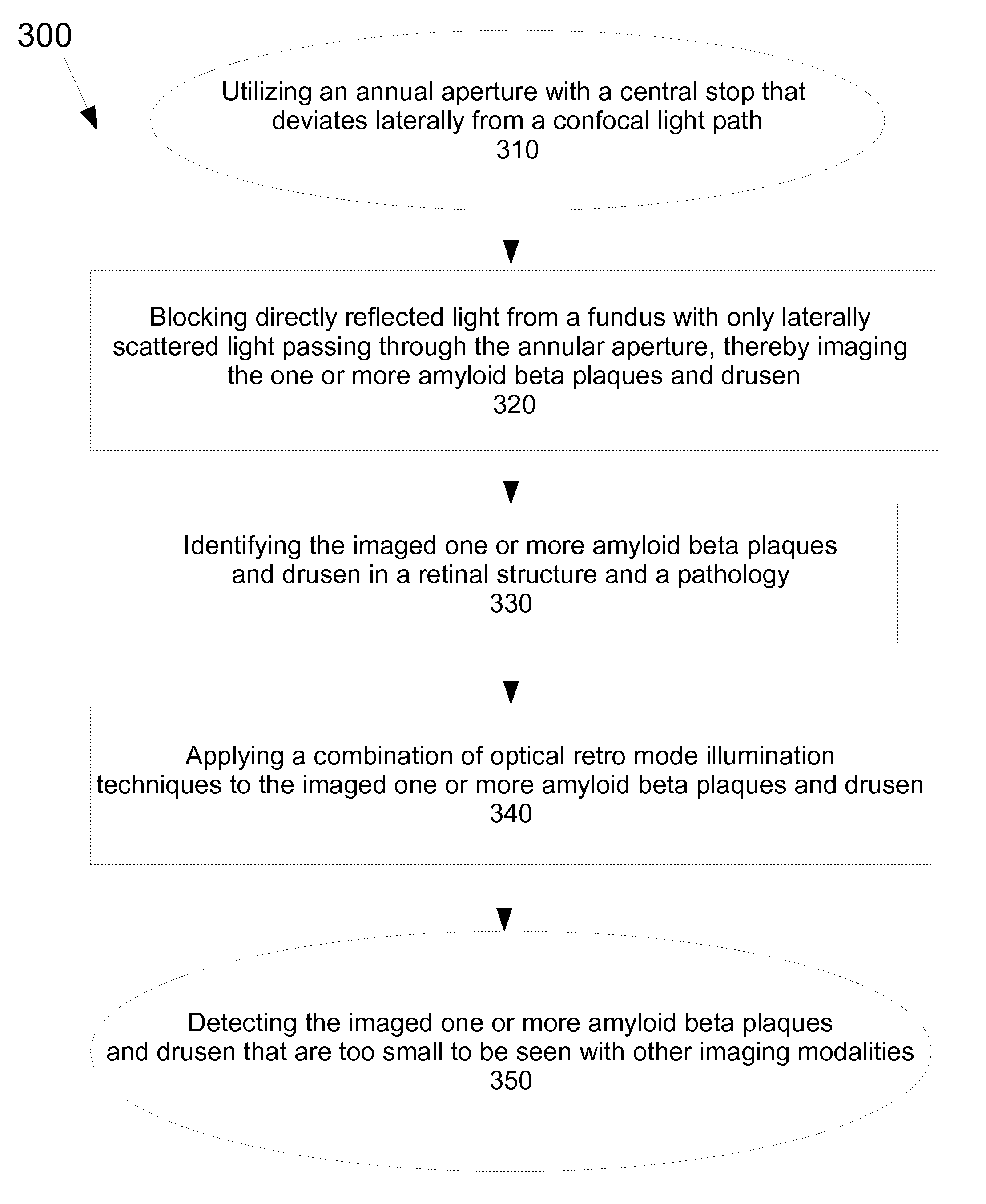 Method for detecting amyloid beta plaques and drusen