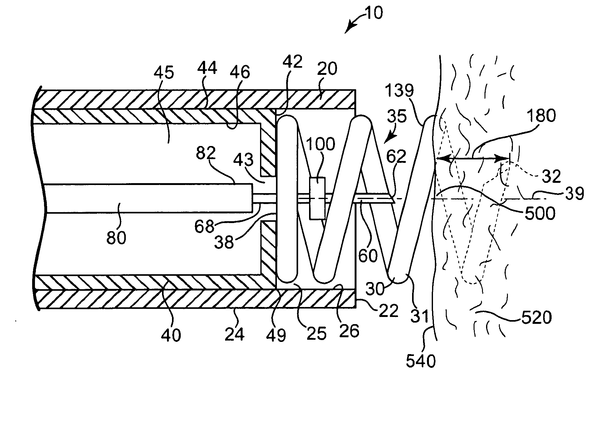 Apparatus and method for controlled depth of injection into myocardial tissue