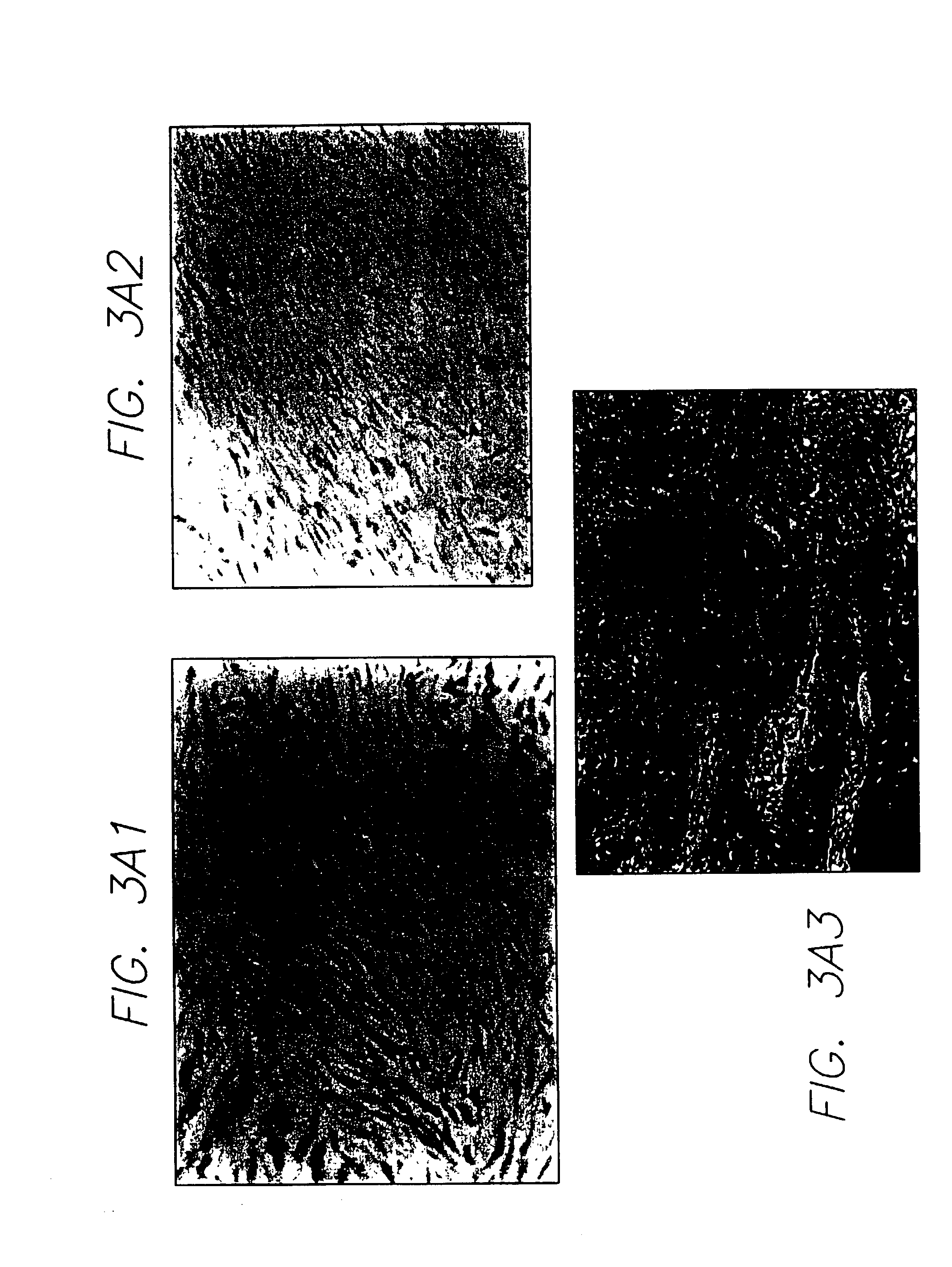 In vivo gene transfer methods for wound healing