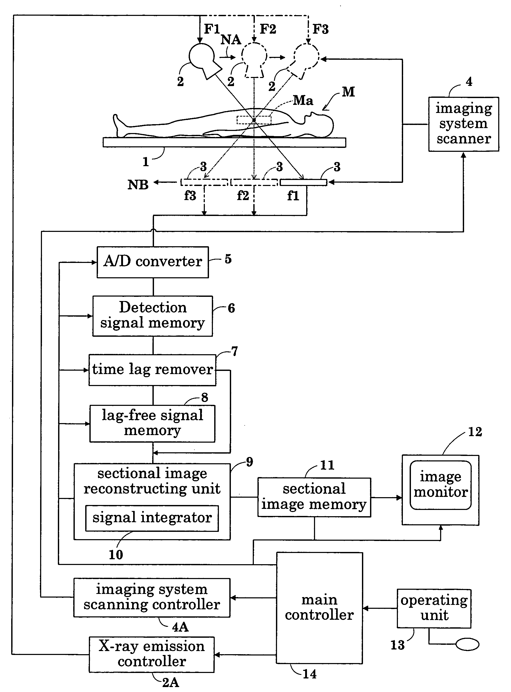 Radiographic apparatus and radiation detection signal processing method