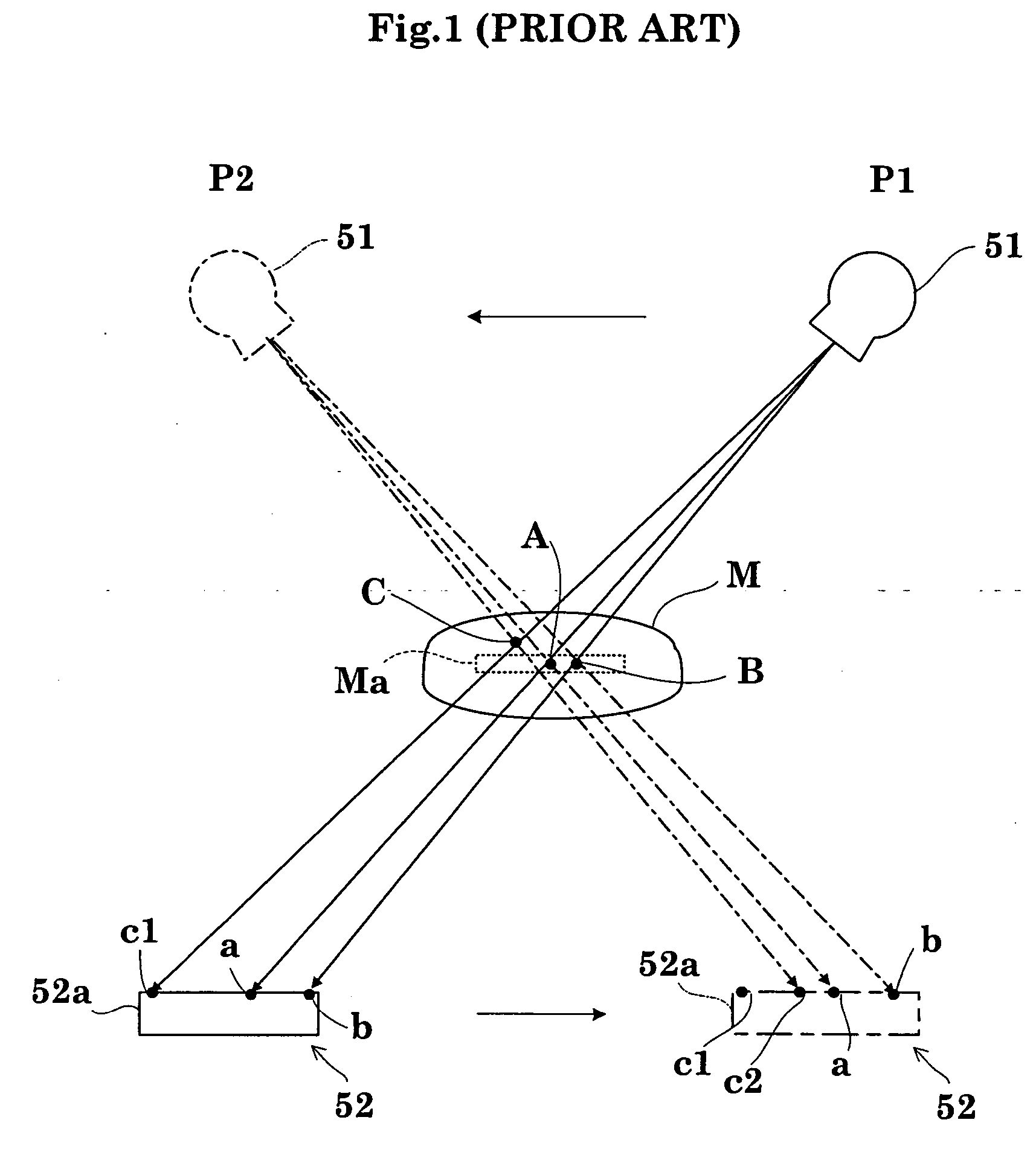 Radiographic apparatus and radiation detection signal processing method