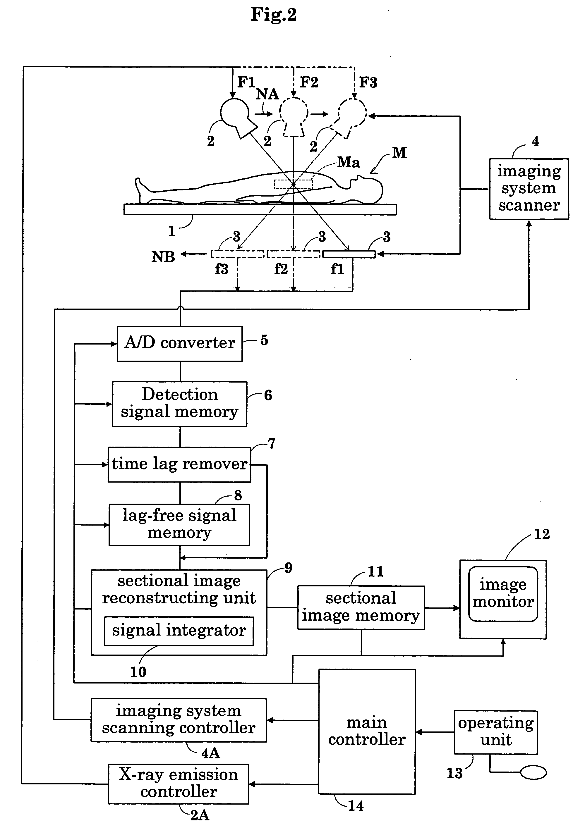 Radiographic apparatus and radiation detection signal processing method