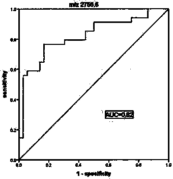 Application of urine gelsolin and polypeptide fragments thereof in lung adenocarcinoma