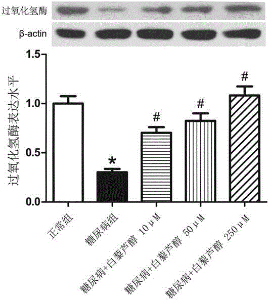 Application of resveratrol in medical titanium alloy implants under condition of diabetes