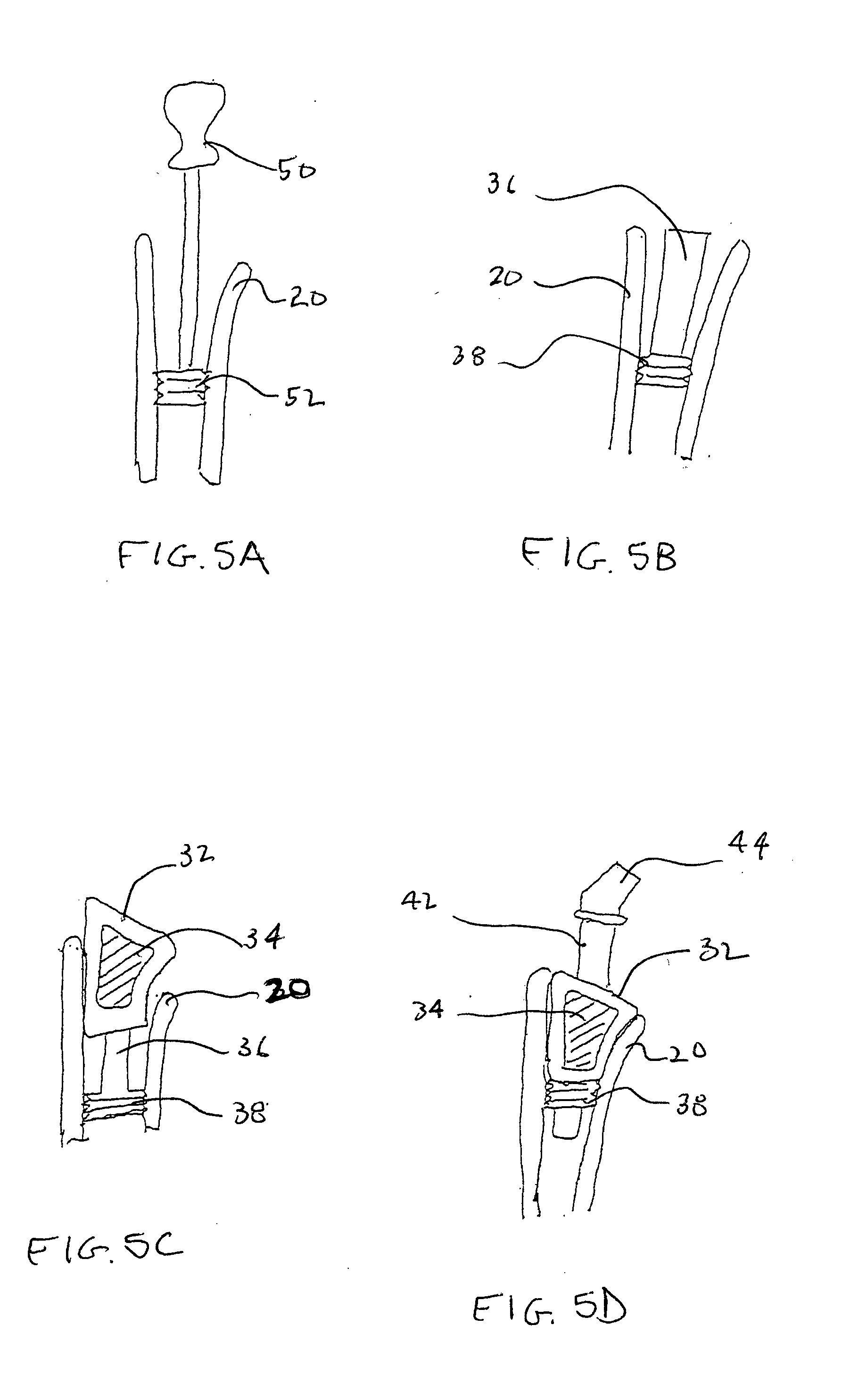 Fusion and arthroplasty devices configured to receive bone growth promoting substances