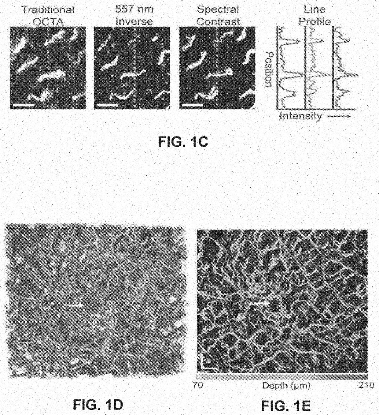 Spectral contrast optical coherence tomography angiography