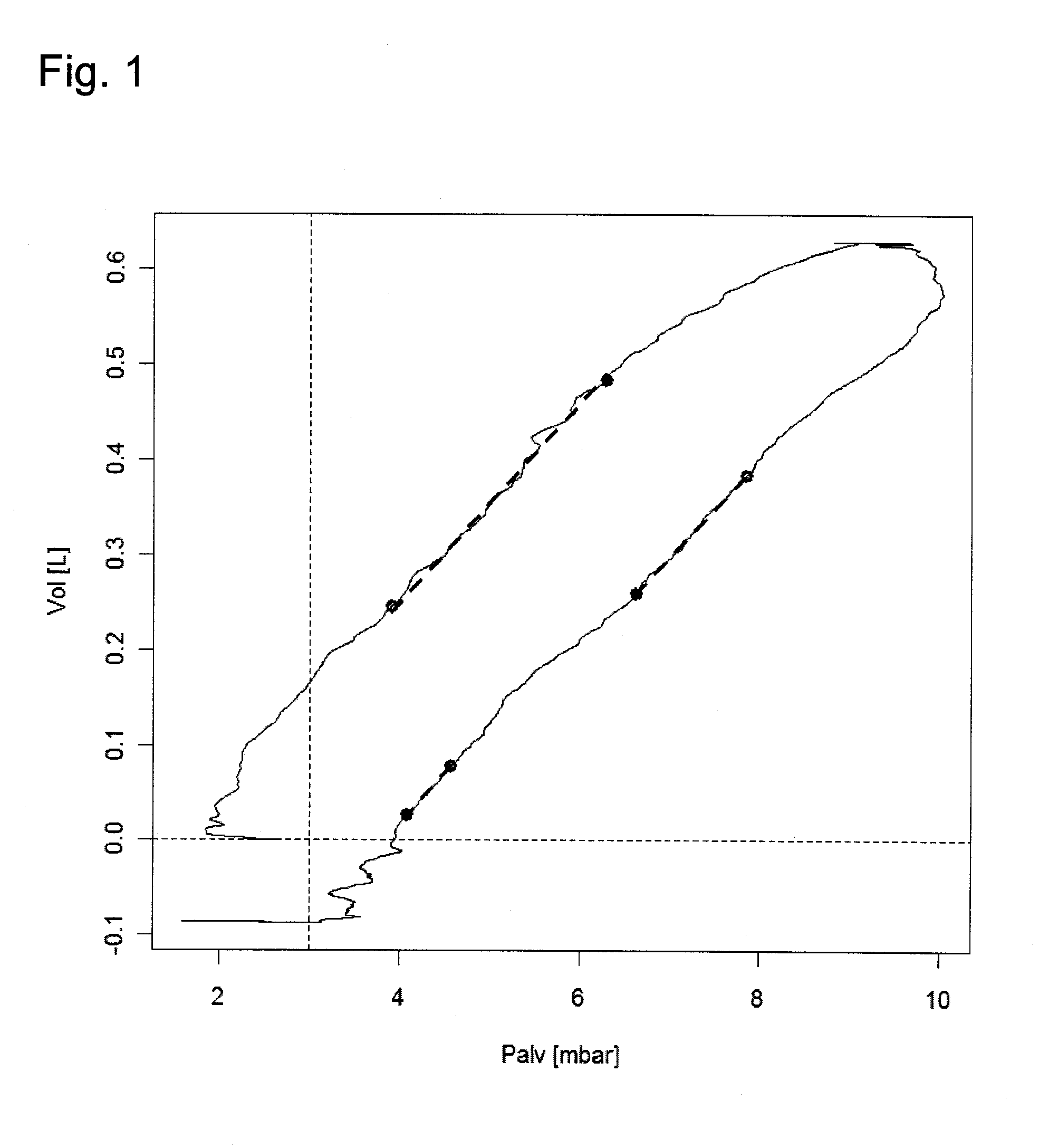 Respirator with automatically controlled pressure-assist respiration