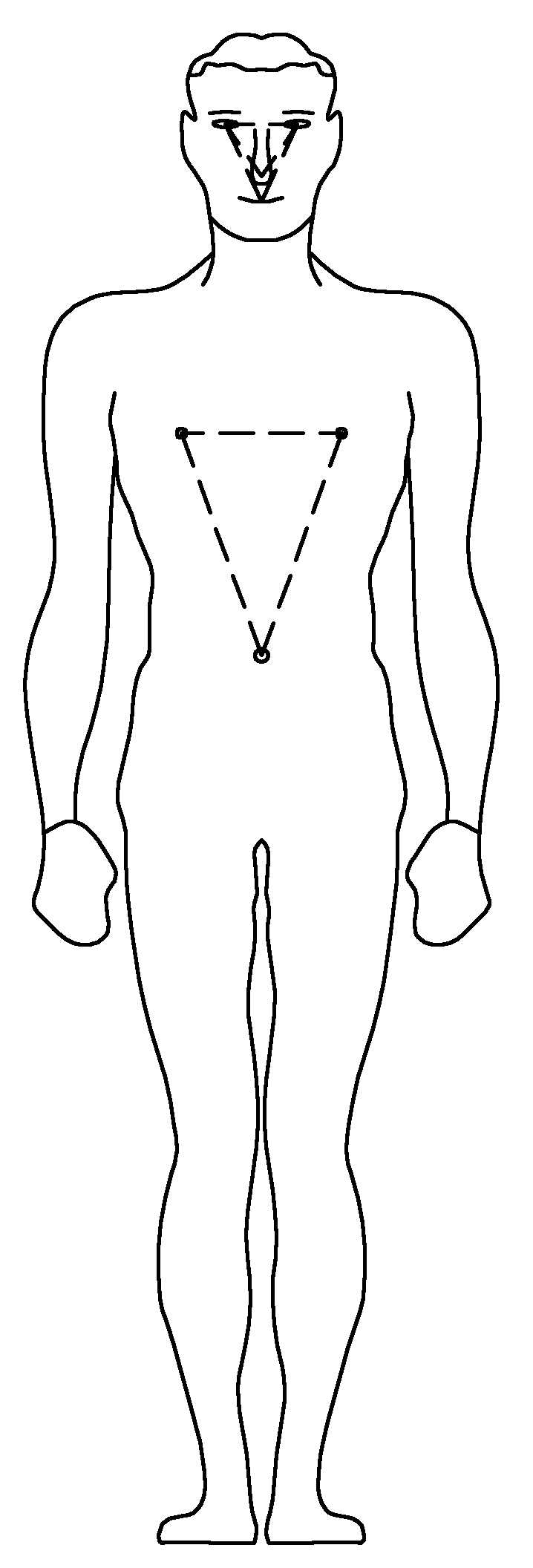 Radiotherapy positioning device