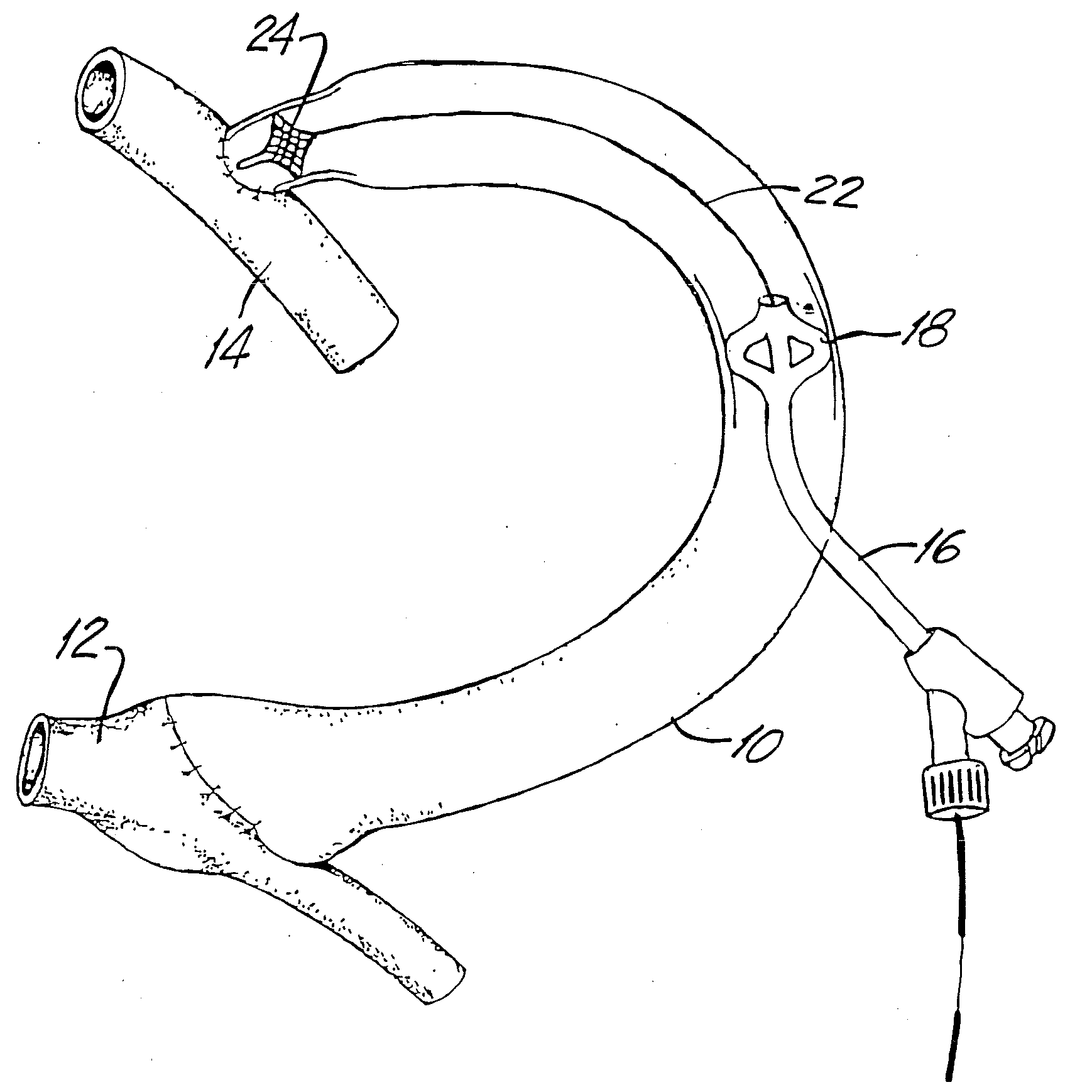 Medical Devices and Methods