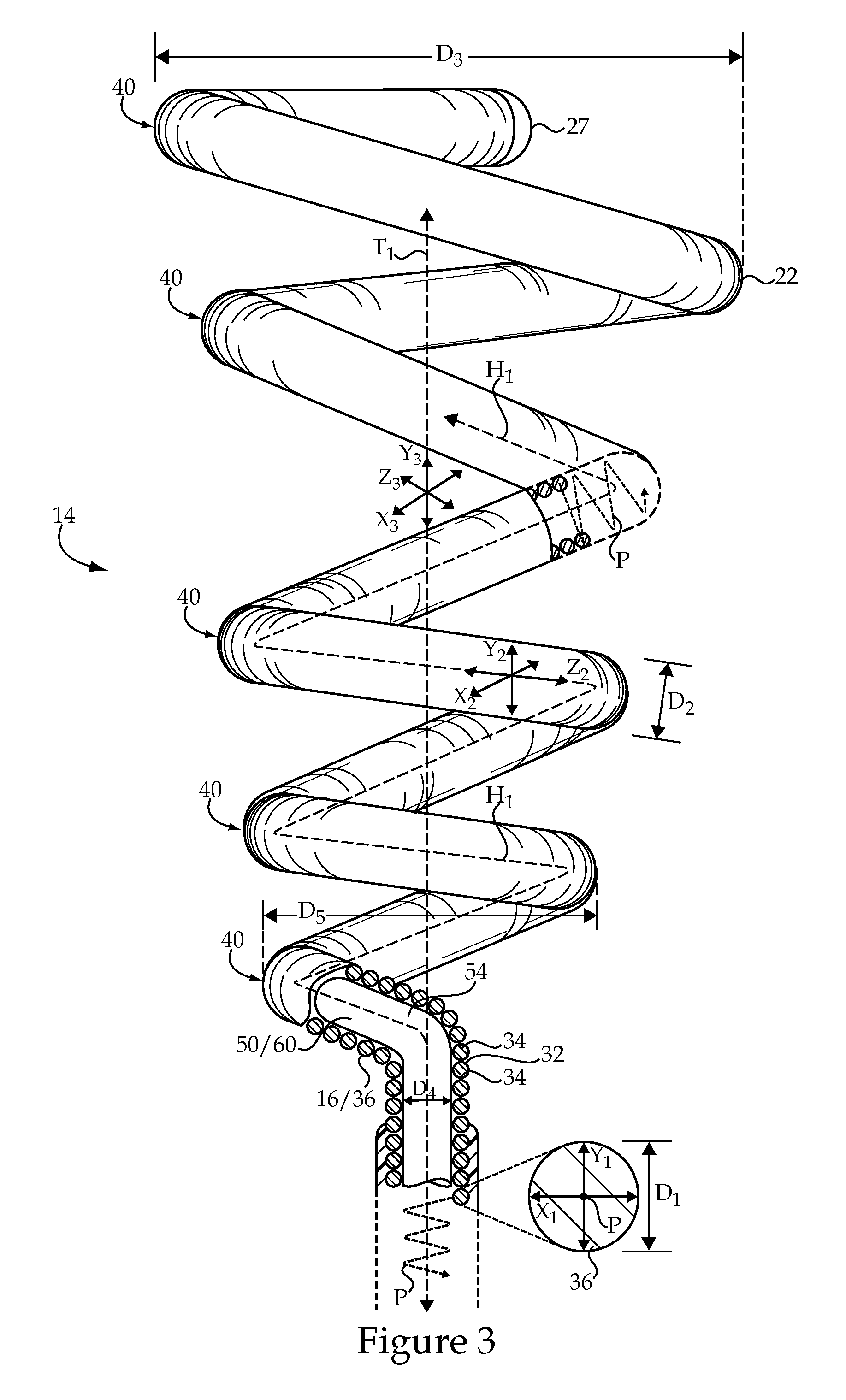 Treatment Fluid Delivery Method, And Turbulator For Promoting Uptake Of A Treatment Agent