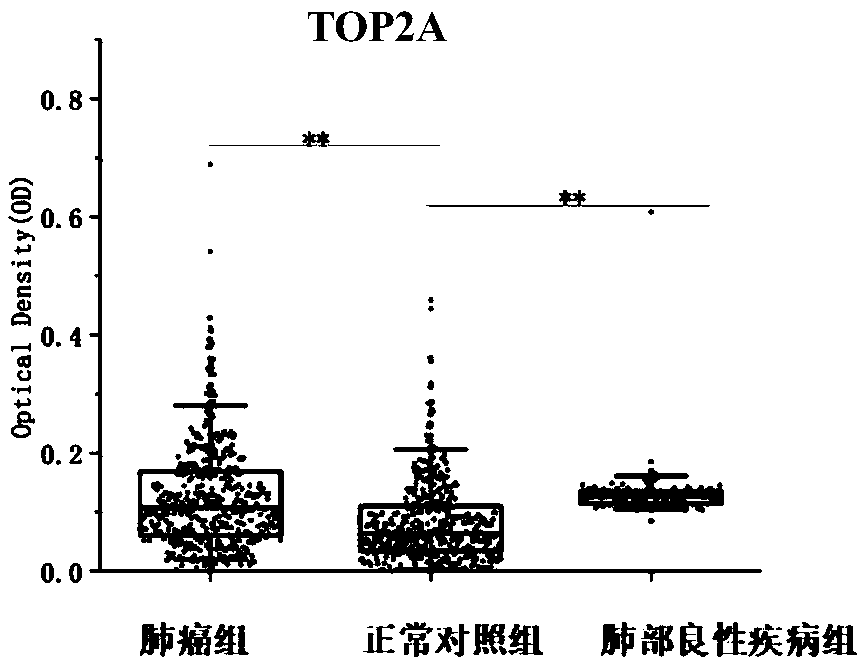 Application of TOP2A (Topoisomerase(DNA)II Alpha) autoantibody as lung cancer diagnostic marker