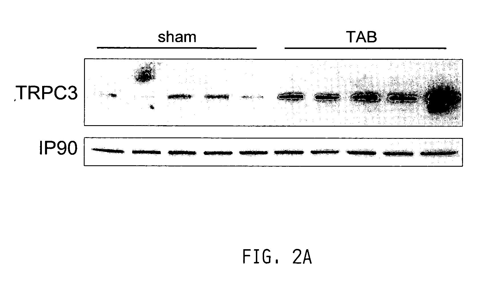 Inhibition of TRP channels as a treatment for cardiac hypertrophy and heart failure