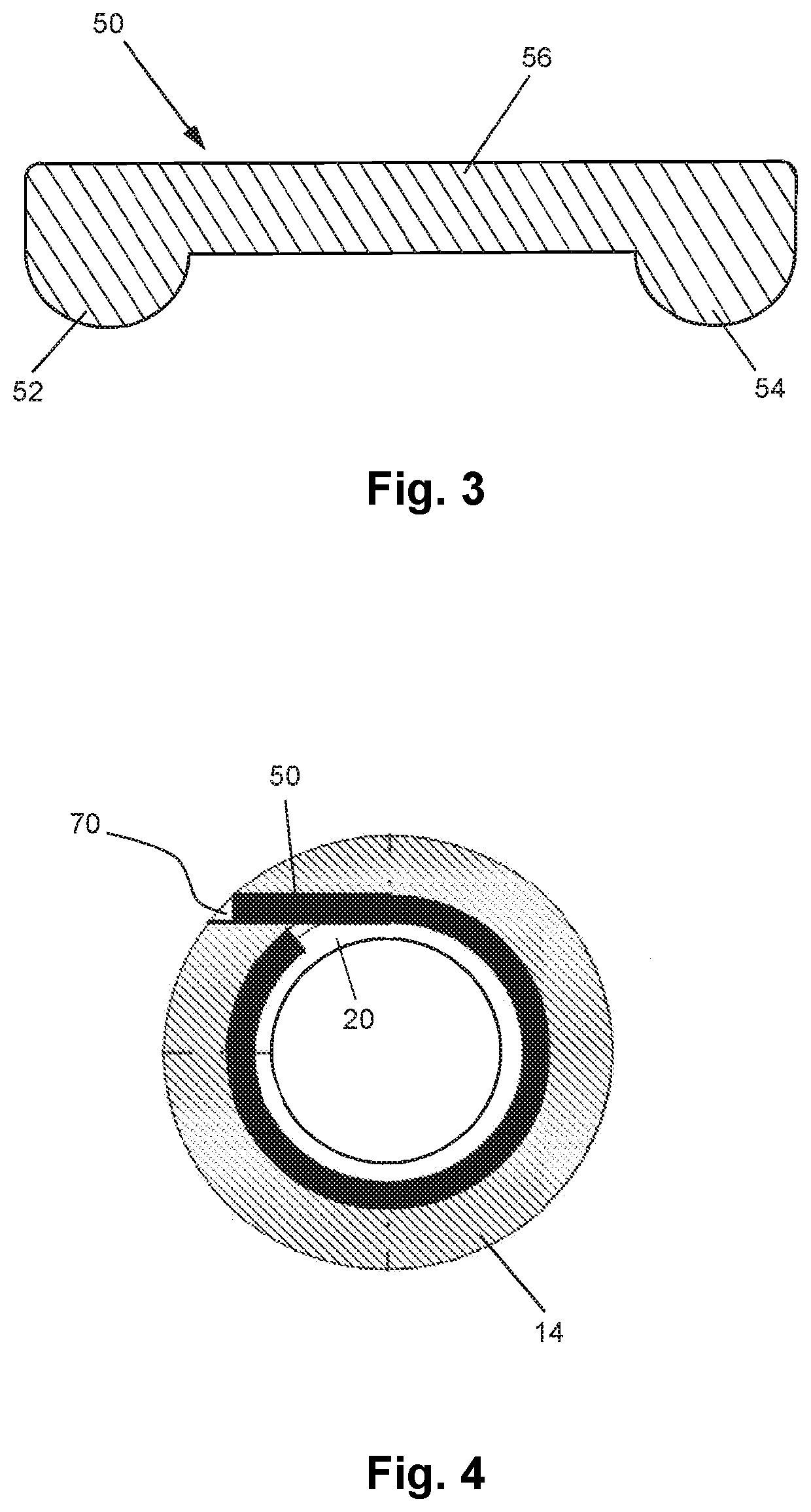 Pipe joint