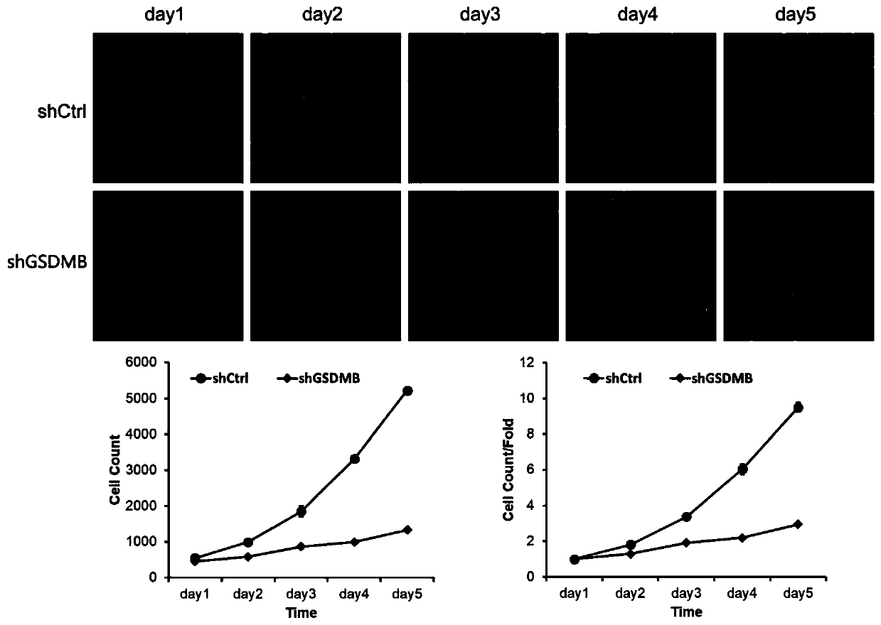 Use of human GSDMB gene and related products