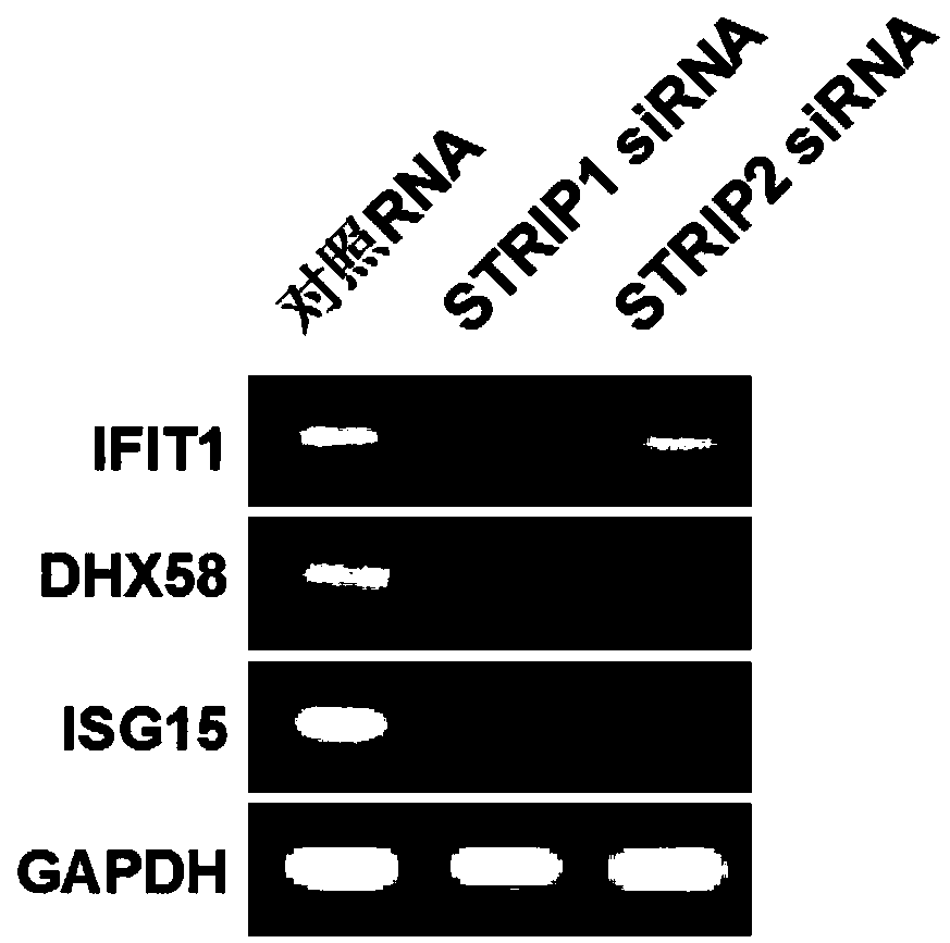 Striatin interacting protein inhibitor and application of inhibitor to preparation of anti-tumor drug