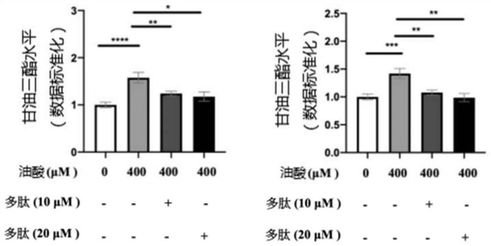 Polypeptide applied to inhibition of intracellular lipid accumulation and synthesis method thereof