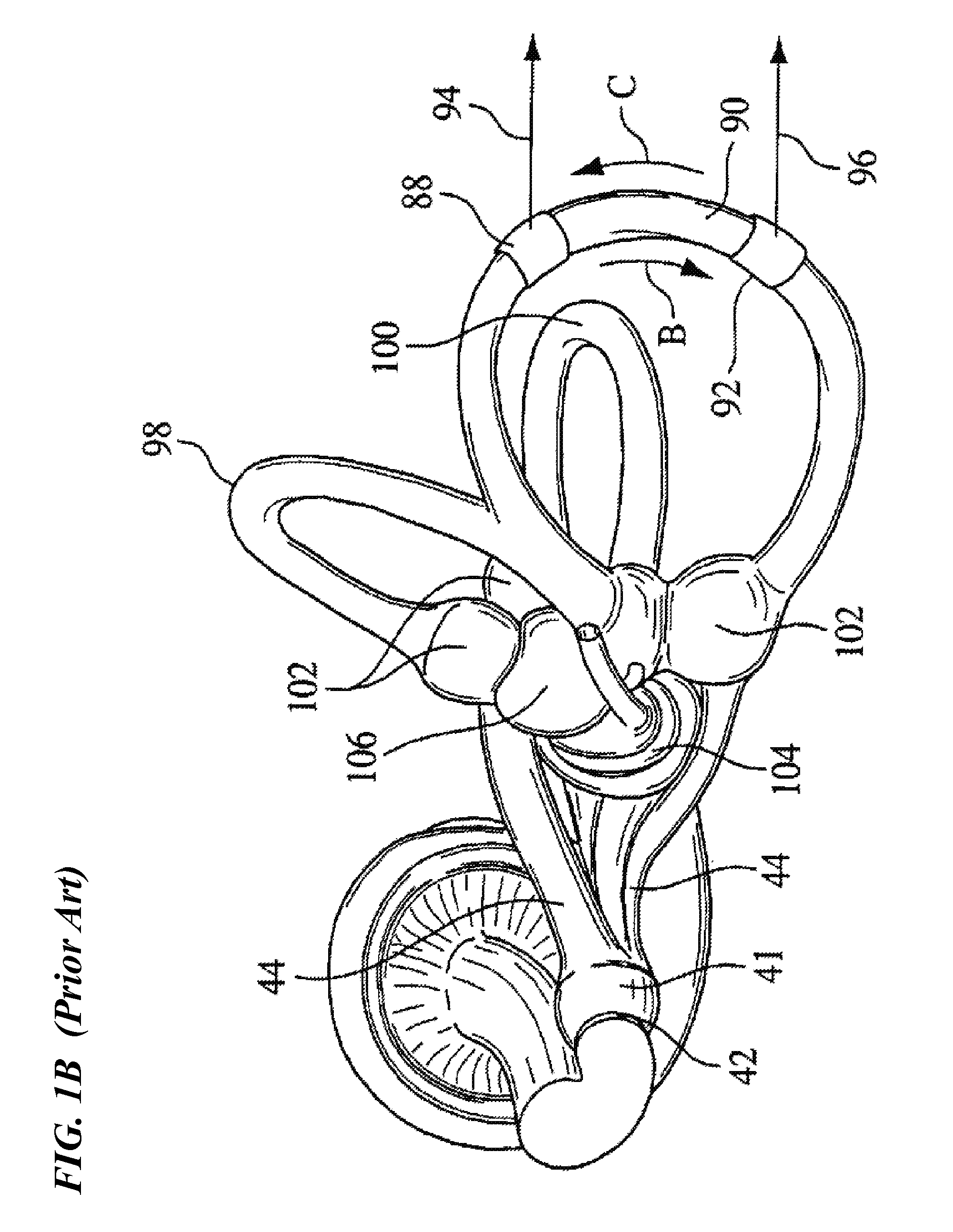 Method and vestibular implant using optical stimulation of nerves