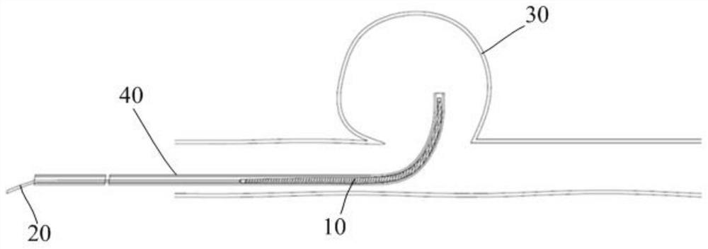 Hemangioma plugging device, hemangioma plugging treatment device and hemangioma plugging system