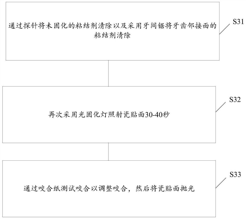 Tooth porcelain veneer bonding method