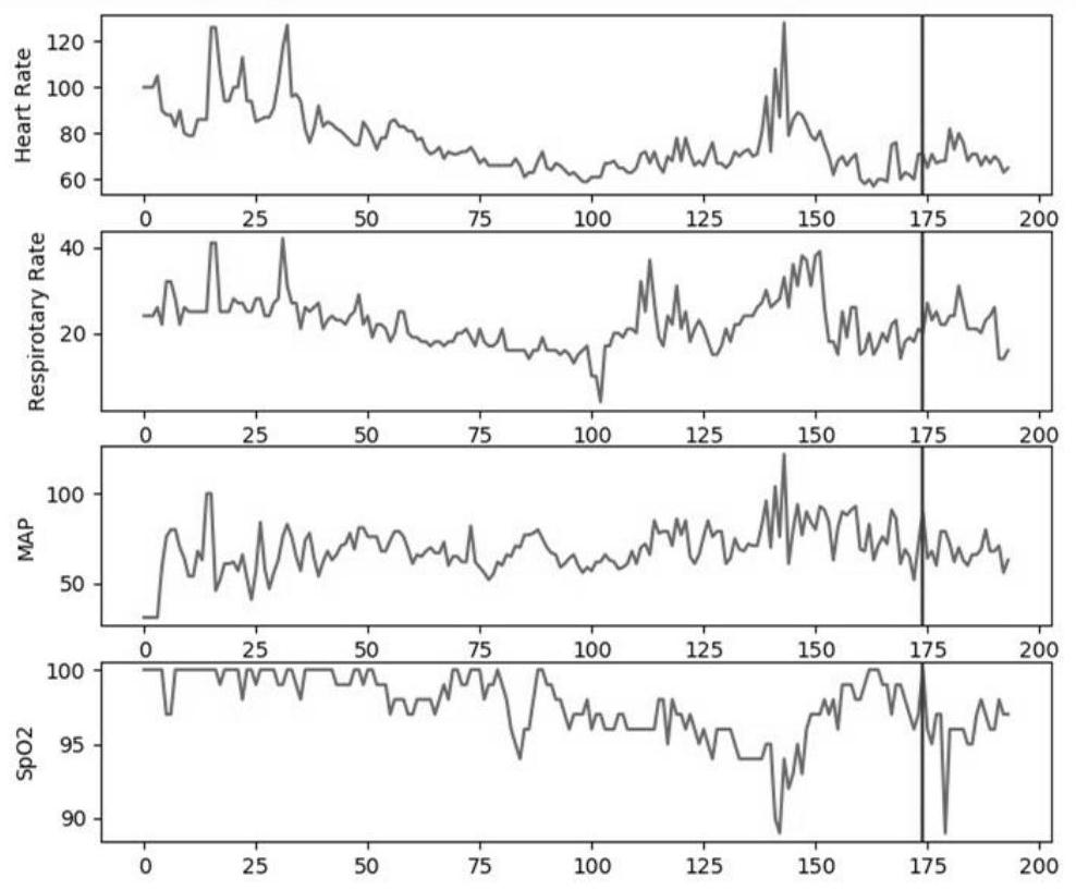 Severe acute respiratory distress syndrome early warning method and system