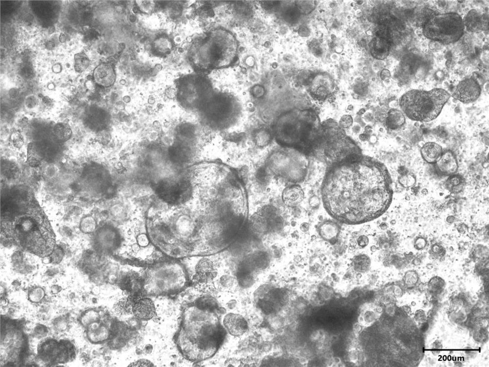 Culture solution, culture reagent combination and culture method for intestinal cancer organs