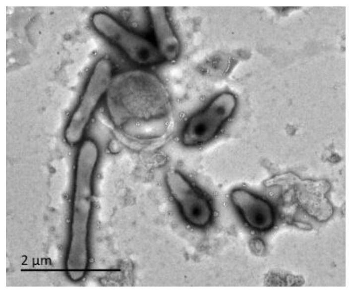 Amidase xam and its encoding gene and application