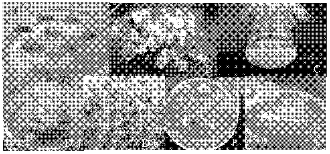 Method for effectively inducing cotton somatic embryo and regenerating plants and culture medium thereof