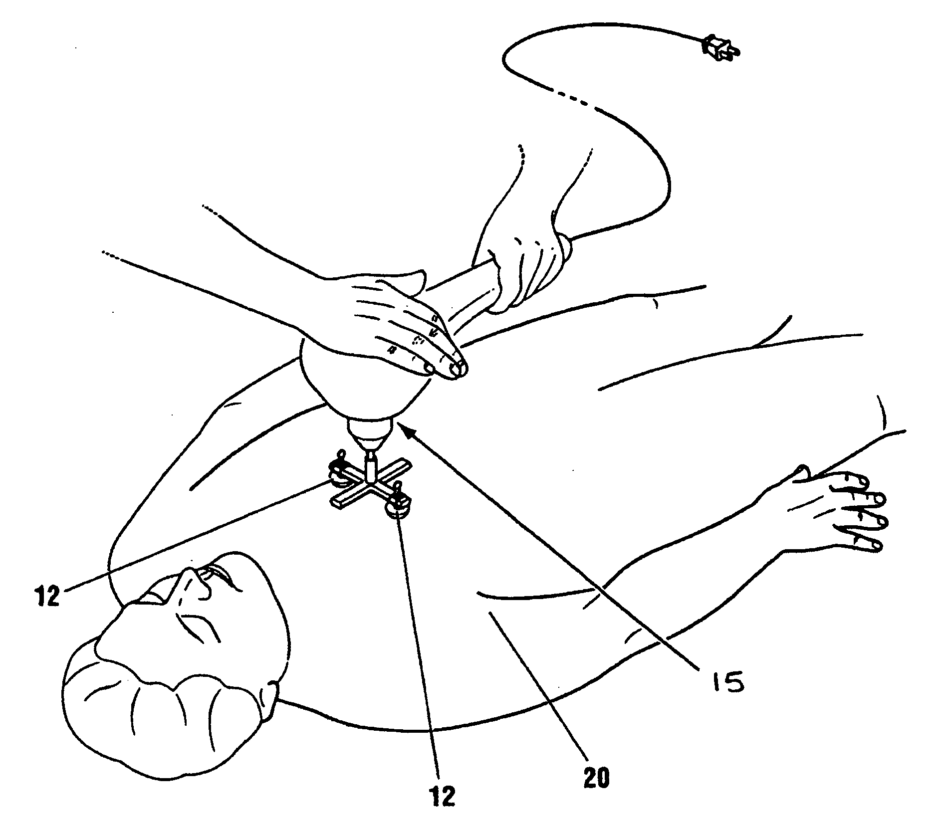 Percussion assisted angiogenesis